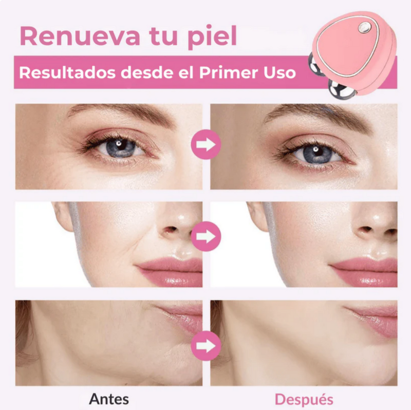 Masajeador Facial Microcorriente